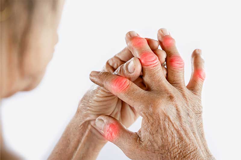 5 Quick Tips: What The Heck Is Arthritis Actually?