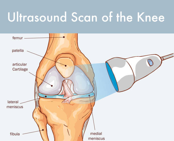 causes knee pain