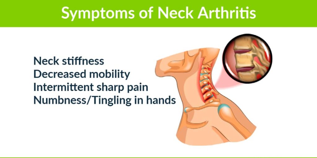 Are Your Painful Headaches Caused By Neck Arthritis