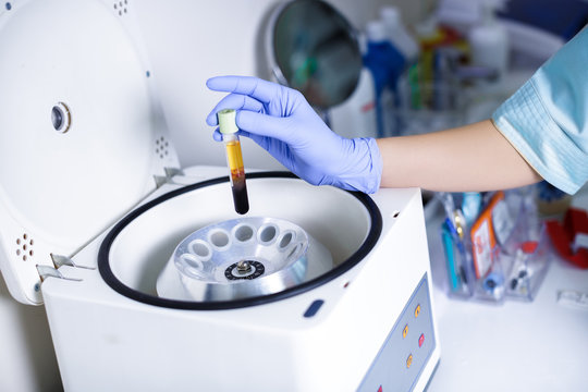 A centrifuge separating blood